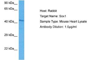 Host: Mouse Target Name: SOX1 Sample Tissue: Mouse Heart Antibody Dilution: 1ug/ml