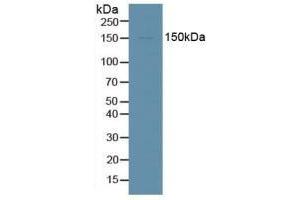 Detection of DDX58 in Human HepG2 Cells using Polyclonal Antibody to Probable ATP-dependent RNA Helicase DDX58 (DDX58) (DDX58 anticorps  (AA 1-211))