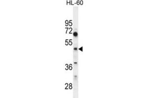 Western Blotting (WB) image for anti-Choline/ethanolamine phosphotransferase 1 (CEPT1) antibody (ABIN2995621) (CEPT1 anticorps)