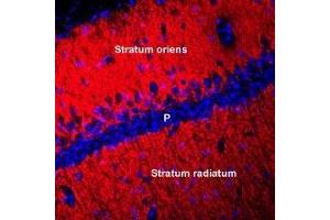 Expression of Connexin-45 in rat hippocampus - Immunohistochemical staining of perfusion-fixed frozen mouse brain sections using Anti-Connexin-45 (GJC1) Antibody (ABIN7043207, ABIN7044085 and ABIN7044086), (1:400), followed by anti-rabbit-Cy3 antibody.
