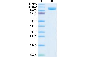 Biotinylated Cynomolgus PSMA on Tris-Bis PAGE under reduced condition.