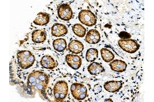 Phospho-HSF1 (Ser326) Antibody at 1/100 staining Rat stomach tissue by IHC-P. (HSF1 anticorps  (pSer326))