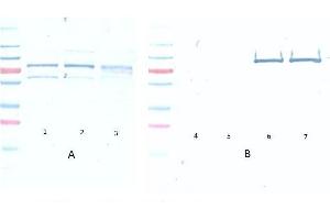 Western Blot of Mouse Anti-Akt pS473 antibody. (AKT1 anticorps  (pSer473))