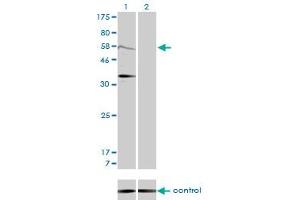 Western blot analysis of MDM2 over-expressed 293 cell line, cotransfected with MDM2 Validated Chimera RNAi (Lane 2) or non-transfected control (Lane 1). (MDM2 anticorps  (AA 101-200))
