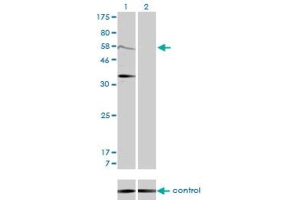 MDM2 Antikörper  (AA 101-200)