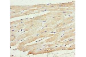 Immunohistochemistry of paraffin-embedded human heart tissue using ABIN7159567 at dilution of 1:100
