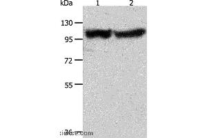 Western blot analysis of Human fetal muscle tissue and hela cell, using ACTN3 Polyclonal Antibody at dilution of 1:400