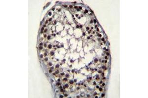 Immunohistochemistry analysis in formalin fixed and paraffin embedded human testis tissue reacted with Glycerol kinase Antibody (N-term) followed by peroxidase conjugation of the secondary antibody and DAB staining.