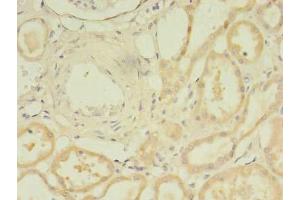 Immunohistochemistry of paraffin-embedded human kidney tissue using ABIN7172078 at dilution of 1:100