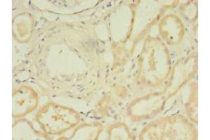 Immunohistochemistry of paraffin-embedded human kidney tissue using ABIN7172078 at dilution of 1:100 (TARS2 anticorps  (AA 369-718))