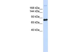 WB Suggested Anti-CAD Antibody Titration:  0. (CAD anticorps  (N-Term))