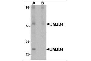 Western blot analysis of JMJD4 in human spleen tissue lysate with this product at 1 μg/ml in (A) the absence and (B) the presence of blocking peptide. (JMJD4 anticorps  (N-Term))