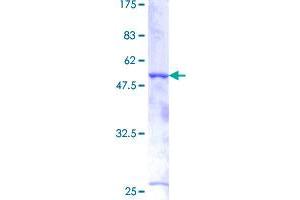 Image no. 1 for Breast Carcinoma Amplified Sequence 2 (BCAS2) (AA 1-225) protein (GST tag) (ABIN1346507)