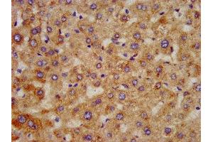 IHC image of ABIN7155981 diluted at 1:300 and staining in paraffin-embedded human liver tissue performed on a Leica BondTM system. (HAO1 anticorps  (AA 161-273))