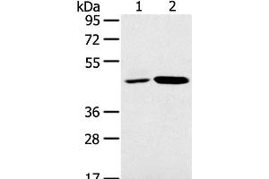 Western Blot analysis of K562 and Jurkat cell using SNX5 Polyclonal Antibody at dilution of 1:250 (SNX5 anticorps)