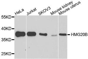 Western blot analysis of extracts of various cell lines, using HMG20B antibody. (HMG20B anticorps  (AA 1-317))