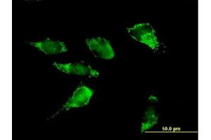 Immunofluorescence of purified MaxPab antibody to PDHA2 on HeLa cell.