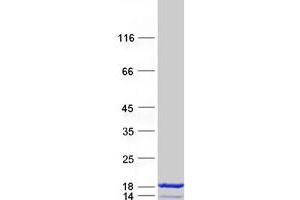 Validation with Western Blot