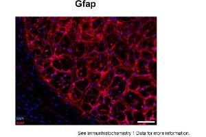 Sample Type: human optic nerve head (frozen)Blue: DAPIRed: GfapPrimary Dilution: 1:250Image Submitted By: Geraint ParfittGavin Herbert Eye Institute . (GFAP anticorps  (N-Term))