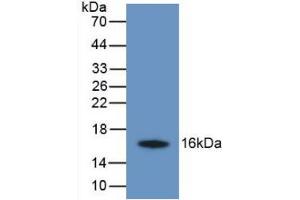 Western blot analysis of recombinant Human TMEM27. (TMEM27 anticorps  (AA 17-137))