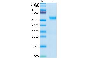 Human VSTM5 on Tris-Bis PAGE under reduced condition. (VSTM5 Protein (AA 29-147) (Fc Tag))
