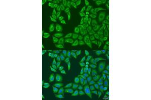 Immunofluorescence analysis of U2OS cells using ABCF2 antibody.