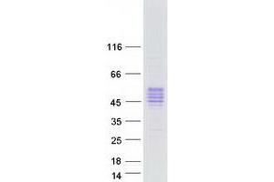Validation with Western Blot