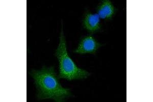 IF analysis of VPS53 using anti-VPS53 antibody (ABIN7599731). (VPS53 anticorps  (AA 11-699))