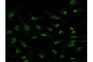 Immunofluorescence of monoclonal antibody to ATF2 on HeLa cell.