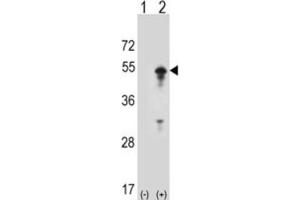 Western Blotting (WB) image for anti-Signal Transducing Adaptor Molecule (SH3 Domain and ITAM Motif) 1 (STAM) antibody (ABIN3001494) (STAM anticorps)