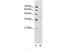 Image no. 1 for anti-GNAS Complex Locus (GNAS) (AA 297-346) antibody (ABIN203496) (GNAS anticorps  (AA 297-346))