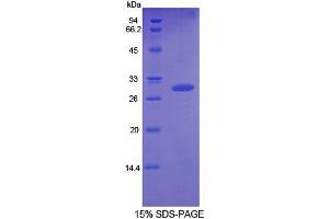 SDS-PAGE analysis of Rat GDF11 Protein. (GDF11 Protéine)