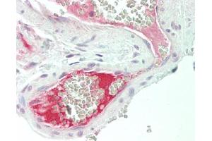 Human Colon, Vessel: Formalin-Fixed, Paraffin-Embedded (FFPE). (F13B anticorps  (AA 216-265))