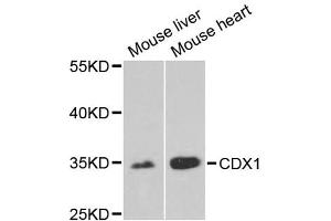 Western blot analysis of extracts of various cell lines, using CDX1 antibody. (CDX1 anticorps)