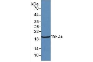 Detection of Recombinant IL18, Rat using Monoclonal Antibody to Interleukin 18 (IL18) (IL-18 anticorps  (AA 37-194))