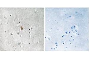 Immunohistochemistry analysis of paraffin-embedded human brain, using IGF1R (Phospho-Tyr1346) Antibody.