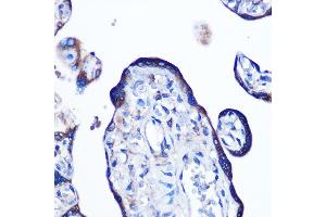 Immunohistochemistry of paraffin-embedded human placenta using Alkaline Phosphatase (ALPL) (ALPL) Rabbit mAb (ABIN7265551) at dilution of 1:100 (40x lens).