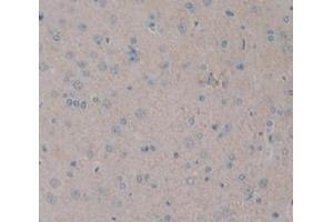 Figure. (NOG anticorps  (AA 28-144))