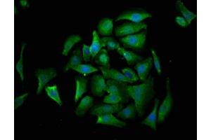 Immunofluorescence staining of A549 cells with ABIN7149542 at 1:530, counter-stained with DAPI. (CRADD anticorps  (AA 1-199))