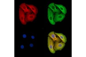 ABIN7095605 and ABIN7099667 staining Hela cells by IF/ICC.