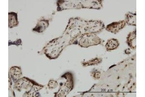 Image no. 1 for anti-Zic Family Member 4 (ZIC4) (AA 249-320) antibody (ABIN466253) (ZIC4 anticorps  (AA 249-320))