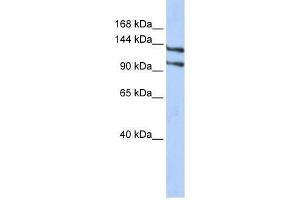 RBM5 antibody used at 1.