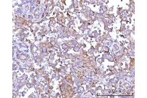 IHC analysis of RPS15A using anti-RPS15A antibody (ABIN7598954).