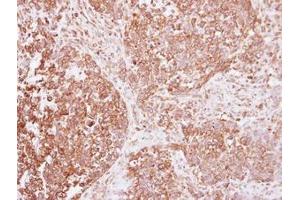 Image no. 1 for anti-Insulin Receptor (INSR) (AA 816-988) antibody (ABIN1498892)