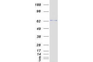 Validation with Western Blot