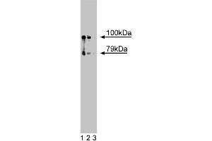 Western blot analysis of hCNK1 on a A431 cell lysate (Human epithelial carcinoma, ATCC CRL-1555). (CNKSR1 anticorps  (AA 10-217))