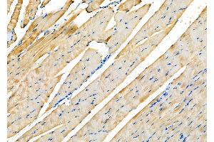 ABIN6258189 and ABIN6273887 at 1/100 staining Rat muscle tissue by IHC-P.