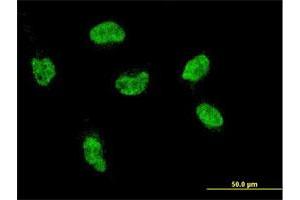 Immunofluorescence of monoclonal antibody to HOXA5 on HeLa cell. (HOXA5 anticorps  (AA 171-270))