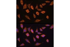 Immunofluorescence analysis of L929 cells using USP5 antibody (ABIN1683231, ABIN3018687, ABIN3018688 and ABIN6220542) at dilution of 1:100. (USP5 anticorps  (AA 1-280))