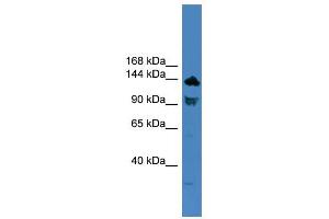 WB Suggested Anti-TLR8 Antibody Titration: 0. (TLR8 anticorps  (C-Term))